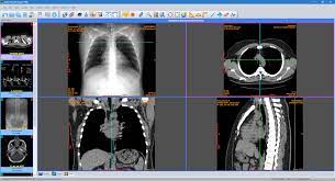 Windows 10 dicom viewer downloads. Jivex Dicom Viewer Light Banksskiey