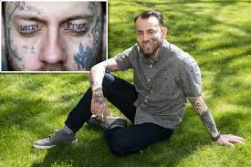 I'm actually pretty happy with the progress of this tattoo removal! Costly Face Tattoo Removals On The Rise As Regret Sets In