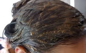 Anju says, cucumber juice is extremely good for your hair. Top 4 Benefits Of Cucumber To Stop Hair Fall Topcount