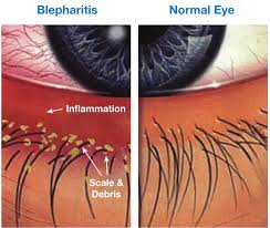 Image result for Blepharis affinis