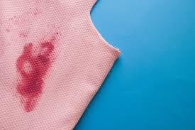 Will sharpie stay on fabric? A Well Tried Remedy For Removing Marker Stains From Clothes