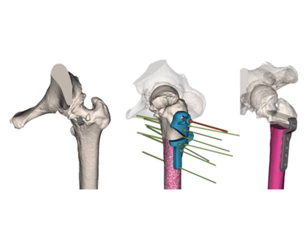 CME Training Workshop on CAD Surgical Margins