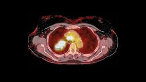 They're not the type to give away all of their secrets right away and they don't tend to broadcast their every thought and emotion like some of the other signs might do. Vitamin C Kills Tumor Cells With Hard To Treat Mutation Science Aaas