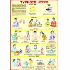 Typhoid Charts