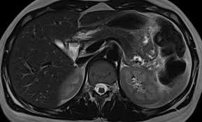 We did not find results for: Mrt Kernspintomographie