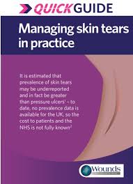 Image result for Skin Tear