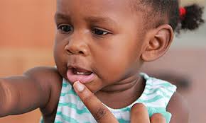 Baby Tooth Problems And Injuries Pampers