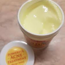 مرهم الكبريت لعلاج حب الشباب من اي هيرب food acne treatment desserts