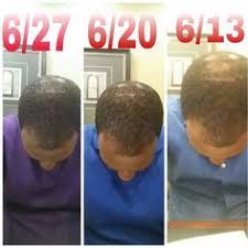 Beaucoup hair herbal hair system sc Two Weeks Of Using The Beaucoup Hair Herbal Hair System Herbal Hair Grow Long Hair Hair System