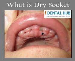 Pin On Dental Care Identalhub