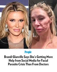 🔗: bit.ly/41X5OAM Brandi Glanville is finding support online amid her  ongoing health crisis. 📷️: Getty; X