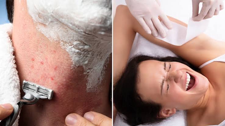 Quais são as desvantagens da depilação com lâminas ou cera? - openLaser