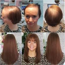 This dream interpretation will solely be about when you lose or cut your hair. Hair Loss Dreamgirlz Hair Extensions