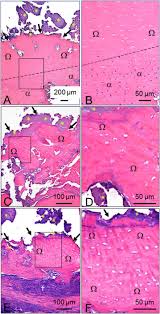 Aching pain in and around your ear. Zoledronic Acid Increases The Prevalence Of Medication Related Osteonecrosis Of The Jaw In A Dose Dependent Manner In Rice Rats Oryzomys Palustris With Localized Periodontitis Sciencedirect