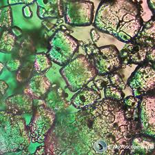 Image result for Polarized Microscopy