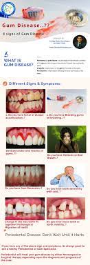 8 Signs Symptoms Of Gum Disease By Dr Somit Jain Gum Disease Swollen Gum Gingival Recession