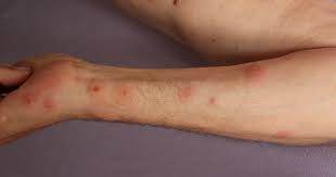 One known scent that repels bed bugs is the pheromones secreted by the nymphs, or baby bed bugs.more items… how can i tell if i have bed bugs or fleas? How Do You Know If Your Have Bed Bugs In Your Home Wicked Bedbugs
