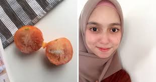 Campurkan 1 sendok makan cuka apel dengan 3 sendok air (gunakan lebih banyak air untuk kulit sensitif). Hanya Guna Tomato Beku Bantu Hilangkan Jerawat Parut Degil Wajah Pun Jadi Glowing Berseri Keluarga