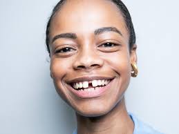 Black skin may have both hyperpigmentation and hypopigmentation. How To Get Rid Of Dark Spots Diy Professional Treatments Glamour