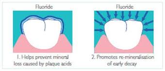 Fluoride also makes your teeth more resistant to acids that come from foods and from bacteria in your mouth. Fluoride