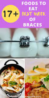 17 Foods To Eat With Braces The First Week Braces Food Braces Friendly Recipes Food