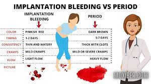 We did not find results for: Implantation Bleeding Vs Period Pictures Causes Signs Symptoms Quiz Youtube