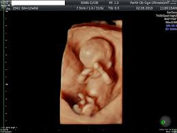 Mom + 1 guest (must be 3 years & older) updated for covid. 3d 4d Ultrasound Pregnancy Pogu