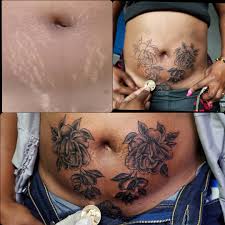Even if you have large clusters of stretch marks that can't be completely covered up by a tattoo, a good artist may still be able to create something that at the very least is able to moderately mask the stretch marks somewhat, and take. Roy Tattoo Covering Stretch Marks 0974 299 366 Kindly Facebook