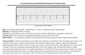 Accelerated junctional rhythm occurs when the av junction fires impulses at above 60 bpm. 13 Junctional Rhythms Ideas Ekg Interpretation Cardiac Nursing Nursing Mnemonics
