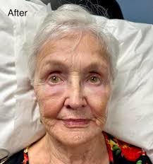 Dr. Linda Fromm at Rapid City Medical Center