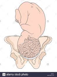 Left Occiput Anterior Loa Baby Fetal Position Pelvis Roa Right Stock Vector Image Art Alamy