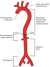 Racgp Aortic Aneurysms Screening Surveillance And Referral
