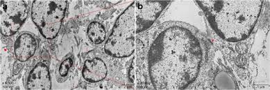 Check spelling or type a new query. Epithelial Mesenchymal Transformation And Apoptosis In Rat Urethra Development Pediatric Research