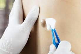 As tumors grow and begin to invade the sphincter muscle, pain is common and often patients experience a sense of fullness and a constant need to evacuate. Tumors Benign Premalignant And Malignant