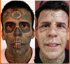🇧🇷🔥 Brazil's “Most Tattooed Man” Regrets His Ink — and Is Burning It  Away Leandro de Souza, once called the most tattooed man in Brazil, is  erasing his past — literally. After