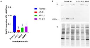 Find facts and statistics for reporting about skin cancer. Frontiers Xeroderma Pigmentosum C Xpc Mutations In Primary Fibroblasts Impair Base Excision Repair Pathway And Increase Oxidative Dna Damage Genetics