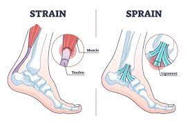 Torn Ligament Or Tendon In Foot