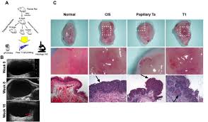 Intravesical Bcg Induces Cd4 T Cell Expansion In An Immune Competent Model Of Bladder Cancer Abstract Europe Pmc