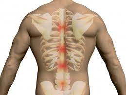 The first 5 bones of spine are known as the cervical vertebrae, the next 12 bones are known as the thoracic vertebrae followed by 5 lumbar vertebrae and then one fused sacral and a coccyx at the last. Thoracic Spine