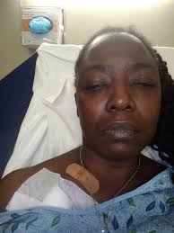 Experiences with Central Venous Catheter Removal and Dialysis