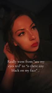 Car Lighter Scar Burn