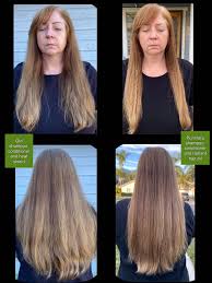Pomifera Rejuvenation With Jennifer - Holy Hyperpigmentation! Just Look At  What Pomifera Did For Her Sunspots! Pomifera Oil Controls Melanin And  Pomifera Rose Serum Is Clinically Proven To Decrease Pigmentation In By