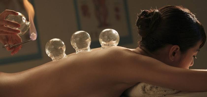 electrotherapy,exercisetherapy,cupping therapy,drynedlling product image