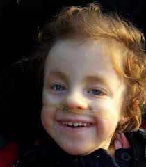 Trusting Doctors when your child has Edwards Syndrome — SOFT UK