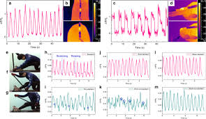Both mean and fluctuation of temperature contributed to thermal acclimation and affected the transcriptome. A High Performance Wearable Strain Sensor With Advanced Thermal Management For Motion Monitoring Nature Communications