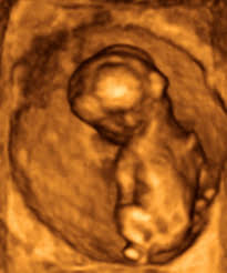 Bei frauen ist infolge des schwächeren skeletts das gewicht etwas geringer, steigt aber häufig nach der menopause an. 15 Schwangerschaftswoche 15 Ssw Alle Infos Eltern De