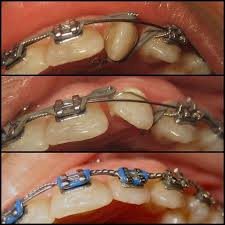 Do You Think Dental Students Should Be Trained In Orthodontics Orthodontics Dental Braces Dental Clinic