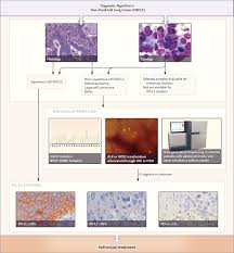 Signs and symptoms of lung cancer typically occur when the disease is advanced. Precision Diagnosis And Treatment For Advanced Non Small Cell Lung Cancer Nejm