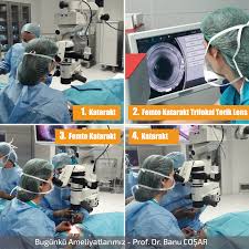 Katarakt Ameliyati Fakoemulsifikasyon Denen Yontemle Yapilir Ameliyatta Kataraktli Lens Ultrason Enerjisi Ile Parcalanarak Temiz Bilgi Doktorlar Agirliklar