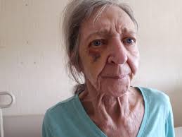 How did this woman end up alone in a psych ward?